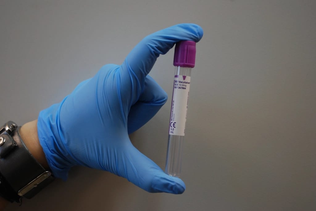A gloved hand holding a blood sample tube